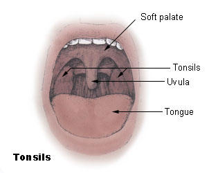 A medical diagram showing the tonsils in the throat.
